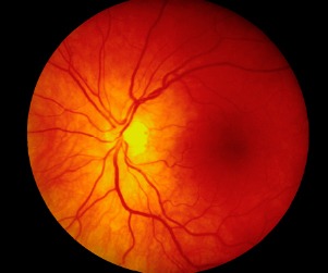 Optic Disc Imaging