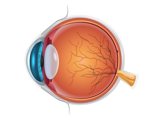 Retinal-Vein-Occlusion